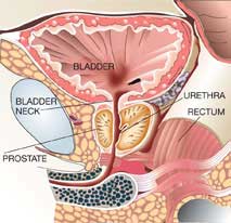 prostata_3