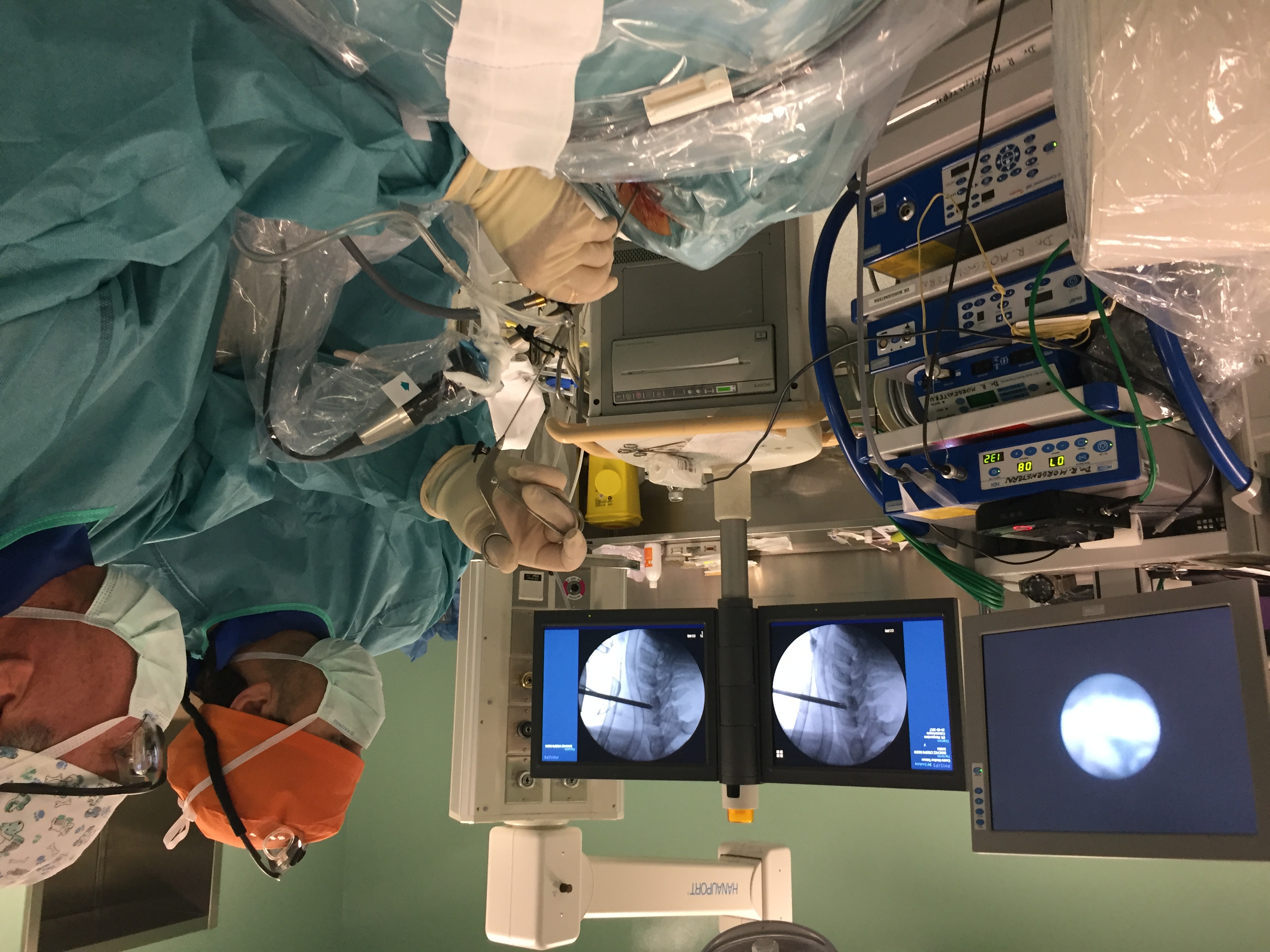 Realizada con éxito la primera cirugía endoscópica para tratar una