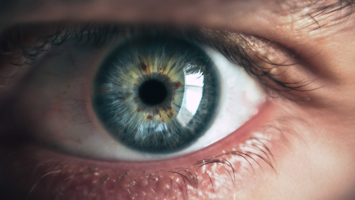 glaucoma-teknon