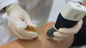 artrosis medicina regenerativa teknon