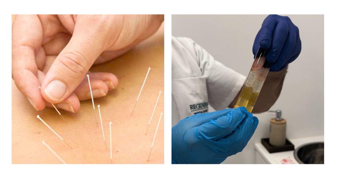 Tendinitis Teknon