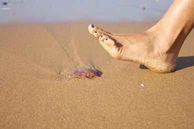 Picadura de erizo de mar