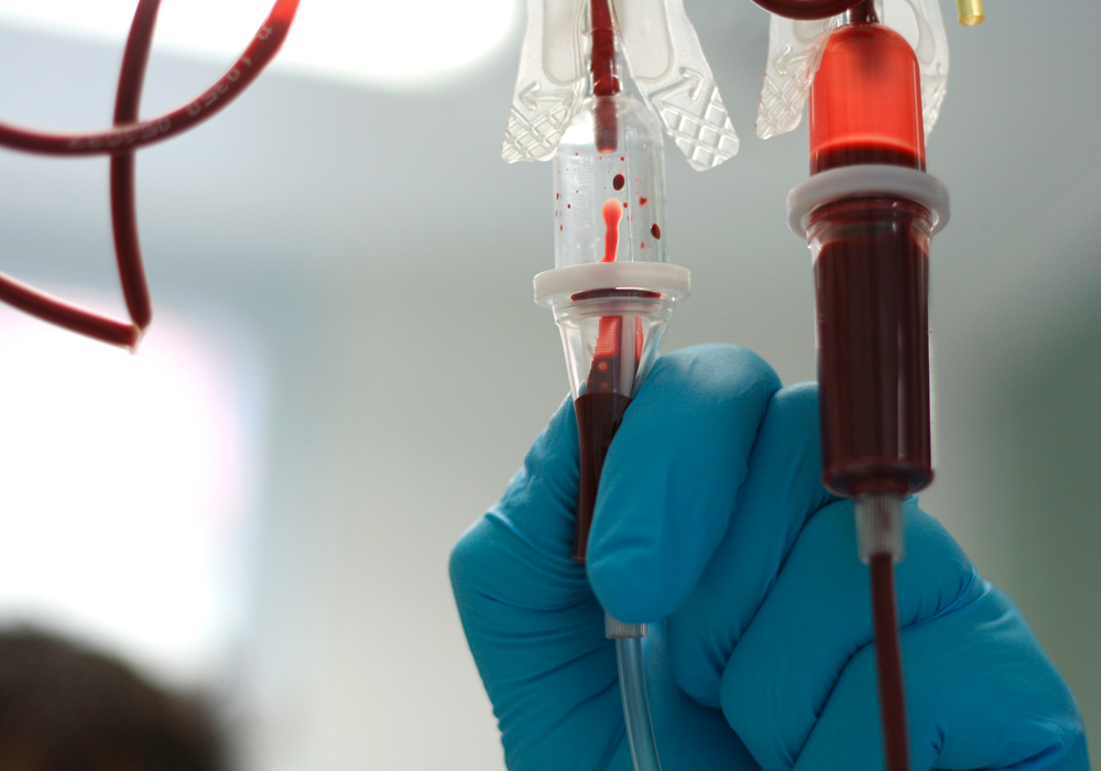 transfusion