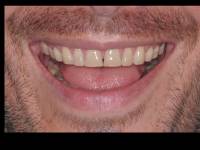 Diapositiva1