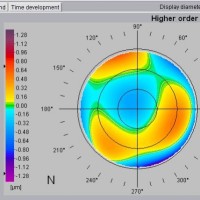 ABERROMETRIA-PRUEBA-OFTALMOLOGIA-OFTALNOVA-BARCELONA