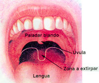 Esquema del paladar