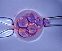 Fecundación de un óvulo en el microscopio