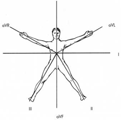 Electrocardiograma 2