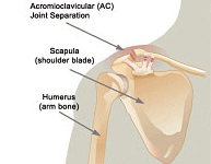 Luxaciones acromioclaviculares_01