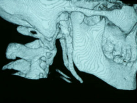 Ejemplo radiografías específicas y TAC