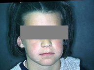 Estado inicial de perfil (derecha)