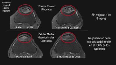 Foto Ensayo Clinico AJSM