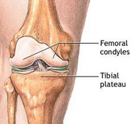 Fracturas tercio inferior fémur