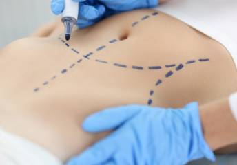 Lipotransferencia