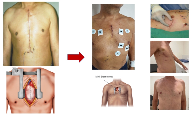 cirugia vascular