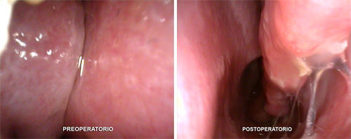 adulto-roncador-6