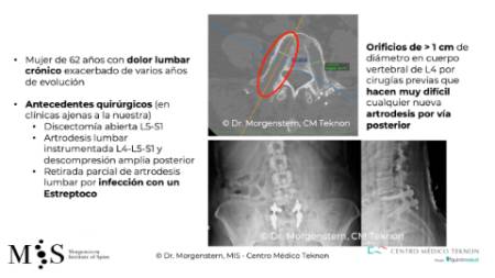 Diapositiva2