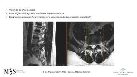 Diapositiva2