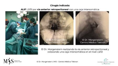 Diapositiva3