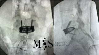 cirugia anterior