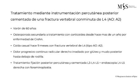 Caso clínico con estabilización percutánea de fractura vertebral inestable