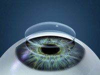 Cornea