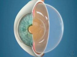Oftalnova-oftalmologos-barcelona-especializados-en-retina-macula-vitreo-esquema4