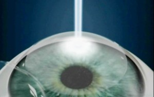Oftalnova_oftalmologos_especializados_en_vista_Cansada_laser-300x190