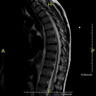 RM Columna Dorsal