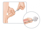 Supositorios intrauretrales para mejorar la disfunción eréctil