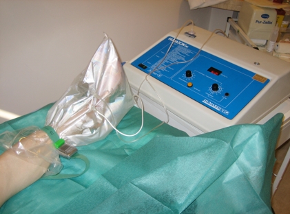 ulceras tratadas con ozonoterapia