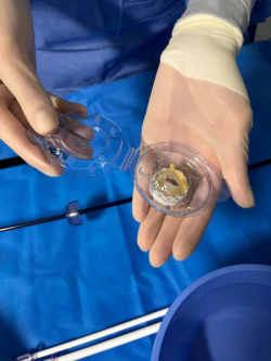 valvula-biologica-transcateter-edwards-resilia