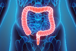 colorectal-profile
