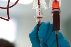 transfusion