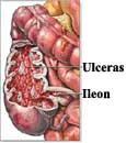 Colitis 2