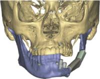 Software 3D