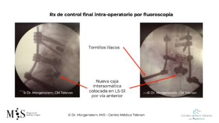 Diapositiva7