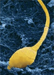 Vista de un espermatozoide al microscopio