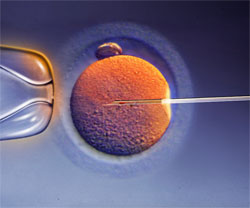 Imagen-de-una-inyección-intracitoplasmática-de-espermatozoides