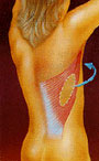 Zona dorsal de donde se extrae la piel para la reconstrucción mamaria