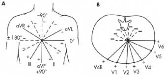 Electrocardiograma 3