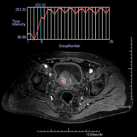 RM Próstata (próstata endorrectal + espectroscopia)