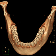 TC Dental