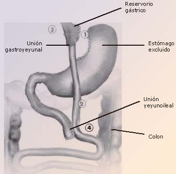 Técnicas mixtas