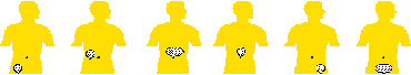 Apendicitis_Cólico biliar_Pancreatitis_Úlcera_Diverticulitis_Espasmos