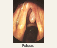 Pólipos1