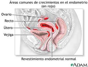 Revestimiento endometrial normal