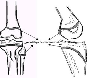Cartílago de crecimiento