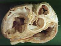 Deteriorament 2