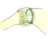 Figura 1. Ligamentos glenohumerales y rodete glenoideo o labrum